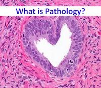 pathology meaning